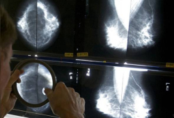 The Importance of Sleep: Tips for Better Rest and Recovery